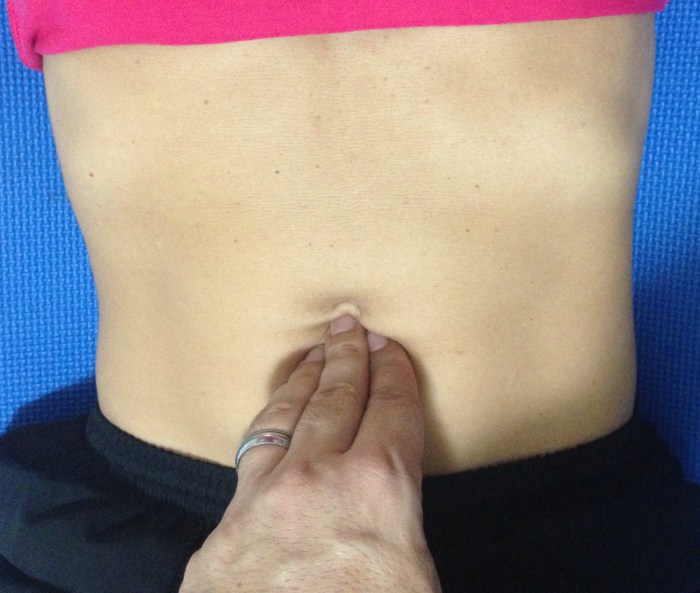 Diástase Abdominal: uma disfunção preocupante