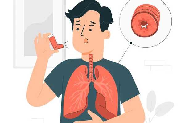 Atuação do Pilates no tratamento da asma